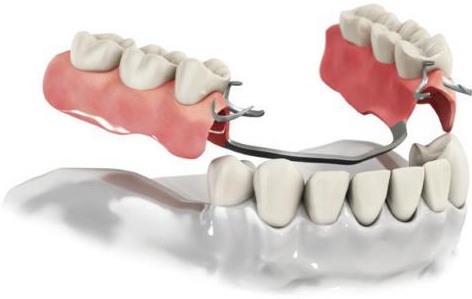 суть протезирования зубов